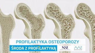 Profilaktyka osteoporozy [upl. by Notsej]