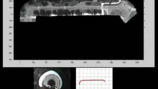 Omnidirectional visual odometry and mosaicing 2008 [upl. by Felic]