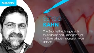 SURGERY Tunnel technique with mucoderm® and Emdogain® for multiple adjacent recessiontype defects [upl. by Airdni]