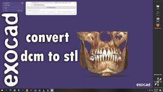 Convert Dicom CT to STL files [upl. by Anehs]