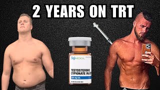 2 YEARS ON TRT  Testosterone Replacement Therapy Energy Anxiety ED Gym Strength Heart Health [upl. by Aiuqat]