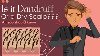 Is It Dandruff Or A Dry Scalp Heres What You Need To Know [upl. by Cohla]