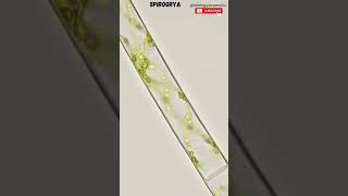 Spirogyra Under Microscope🔬 Filamentous alga  spirogyra biologyexams4u [upl. by Hawger]