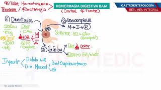 Gastroenterología  Hemorragia digestiva baja [upl. by Grados]