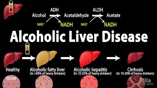 Alcoholic Liver Disease Animation [upl. by Selegna]