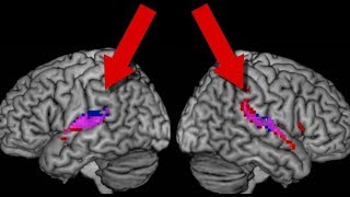 Do Human Brains Synchronise [upl. by Joktan66]