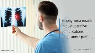 Emphysema results in postoperative complications in lung cancer patients [upl. by Esimaj]