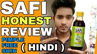 SAFI Removes Pimples   Hindi  SAFI FULL HONEST REVIEW  My Experience With SAFI [upl. by Conal]