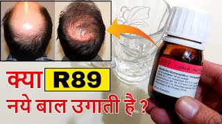 R89 Homeopathic medicine Review  बालो का झड़ना रोके  नए बाल उगाये  Best Medicine for Hairfall [upl. by Reemas]