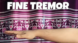 Fine Tremor  Simplified ✔ [upl. by Tezil]