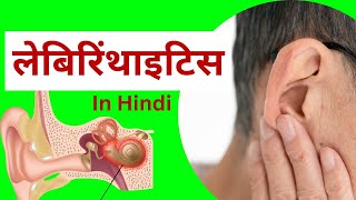 लैबिरिंथाइटिस  कारण लक्षण प्रबंधन  nursing notes in hindi  labyrinthitis in hindi [upl. by Elyse]