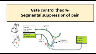 Gate Control Theory of Pain Simplified [upl. by Hatcher542]