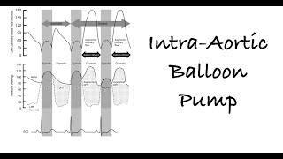 Timing and triggering of the Intraaortic Balloon Pump IABP [upl. by Palestine]