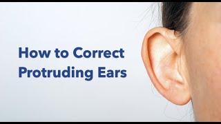 Otoplasty ear pinning surgery explained [upl. by Razid]