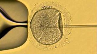 ICSI human sperm injection in vitro Fertility Specialists of Texasavi [upl. by Orms]