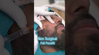 NonSurgical Face Lift by Clinic Eximus shortsfeed shorts [upl. by Doti327]