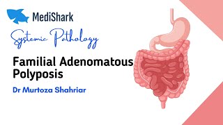 Systemic Pathology Familial Adenomatous Polyposis Dr Murtoza Shahriar [upl. by Naitsirhk538]