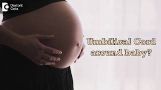 What causes the umbilical cord to wrap around baby  Dr Sapna Lulla [upl. by Tedie]