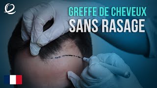 Greffe de cheveux sans rasage  Méthodes de greffe de cheveux à Clinicana Istanbul Turquie [upl. by Laehcor]