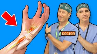 Carpal Tunnel Syndrome  Causes and Treatments [upl. by Peony163]