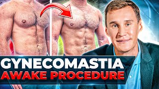 How To Fix GYNECOMASTIA in one AWAKE procedure [upl. by Grover936]