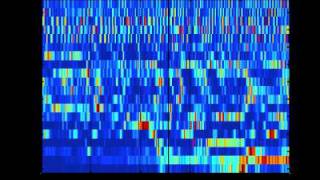 SCHIZOPHRENIA AS SOUND listening to the dynamic brain [upl. by Trimmer]