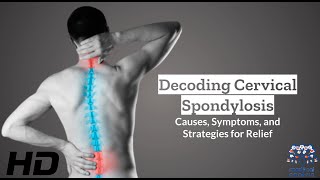 Cervical Spondylosis 101 Causes Symptoms and Treatment Insights [upl. by Odell]