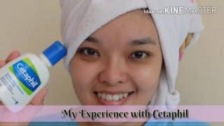 My Review and Experience with Cetaphil Gentle Skin Cleanser [upl. by Esinek]