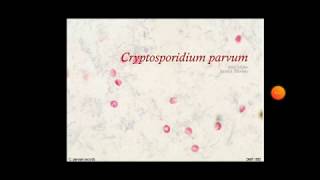 cryptosporidium parvum [upl. by Oigolue846]