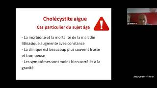 29 Complications de la lithiase vésiculaire Dr BENBETKA [upl. by Ahsiekar]