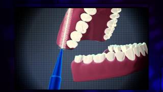 How to use an interdental brush effectively [upl. by Akinar]