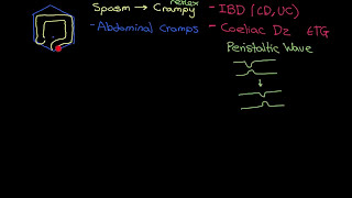 Irritable Bowel Syndrome Part 1 [upl. by Ahseirej]