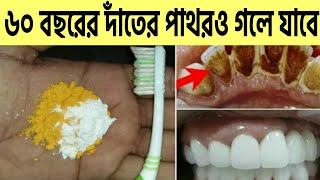 ৬০ বছরের দাঁতের কালো পাথরহলুদ দাগ দূর হবে।দাঁতে পোকাদাঁতে ব্যথামাড়ি সমস্যায় শুধু এটি ব্যবহার করুন [upl. by Lenno934]