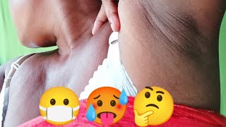 Armpit Blackhead Kaise Remove Kare  waxing video [upl. by Packer]