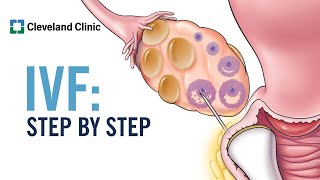 How Does In Vitro Fertilization IVF Work A StepbyStep Explanation [upl. by Aryk588]