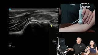 Webinar MSK Power Hour  Elbow [upl. by Enaffit]