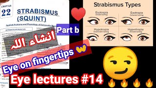 Eye lectures 14  Strabismus Squient exotropia entropia hypertropia hypotropia eye hirshburg [upl. by Teerprug]