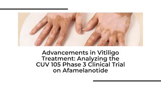 New HOPE for vitiligo  Phase 3 Clinical Trial of Afamelanotide amp Phototherapy  vitiligotreatment [upl. by Refinaj]