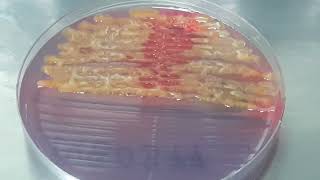 Serratia fonticola on CLED Agar Uropathogen [upl. by Auj]