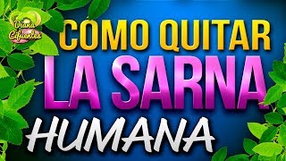 Como Curar La Sarna Humana De Una Forma Rápida Y Eficaz [upl. by Esihcoc]