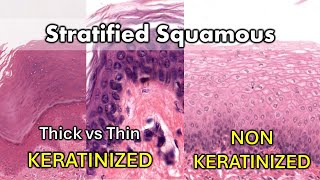 Keratinized vs Non Keratinized Thick vs Thin [upl. by Ttezzil]