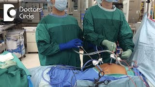 Dos amp Donts after Gynaecologic Laparoscopic Surgeries  Dr Shafalika Boriah [upl. by Primavera155]