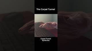 The Carpal Tunnel Syndrome in 22 seconds😯 [upl. by Sicular]