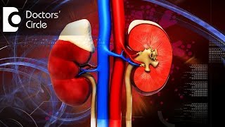 What is Prerenal amp Postrenal Acute Kidney Injury What is Uremic Syndrome  Dr Manoharan B [upl. by Rhoda486]