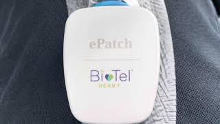 Philips ePatch Holter Heart Monitor [upl. by Anbul]