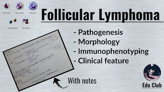 Follicular lymphoma  Non Hodgkins Lymphoma  Pathology [upl. by Azaleah]