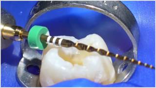 WaveOne Gold ® Technique  Dr Willy Pertot  Dentsply Sirona [upl. by Michon]