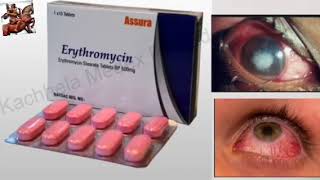 Antibiotic tablet ।। Erythromycin ।। Eye infection ।। Optometry Solution [upl. by Kyre]