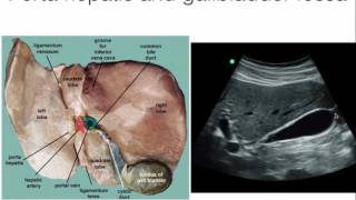 Intro to hepatobiliary ultrasound [upl. by Greene]