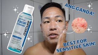 OXECURE ULTRA GENTLE FACIAL CLEANSER REVIEW FOR ONE MONTH  BEST FOR SENSITIVE SKIN AND BREAKOUTS [upl. by Ajaj]